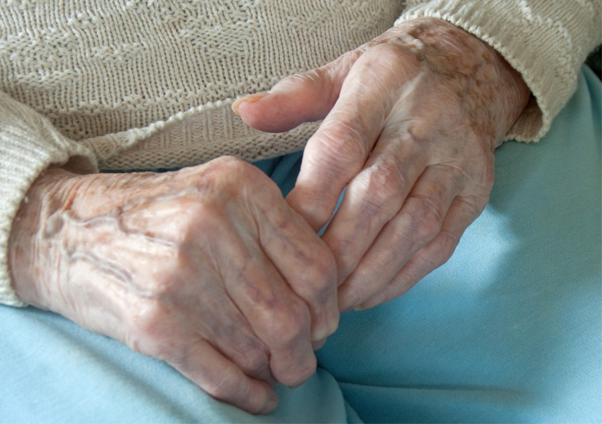 Senior Care in San Diego CA: Senior Health: Arthritis